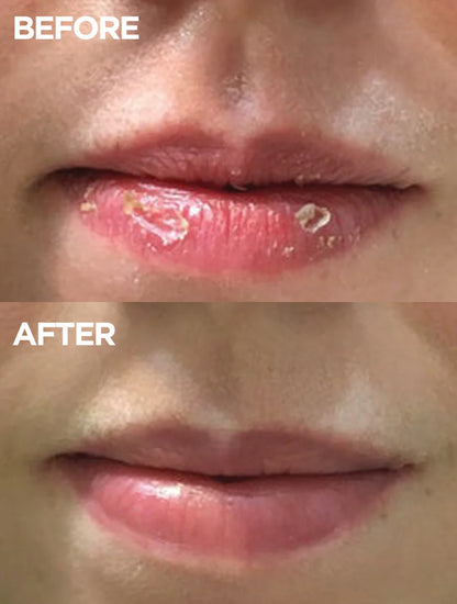 Mystara™ Lip Definition Kit