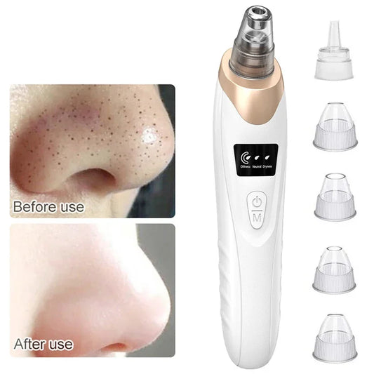 Electric Blackhead Remover Vacuum Cleaner Black Spots Removal Facial Deep Cleansing Pore Cleaner Machine Face Skin Care Tools